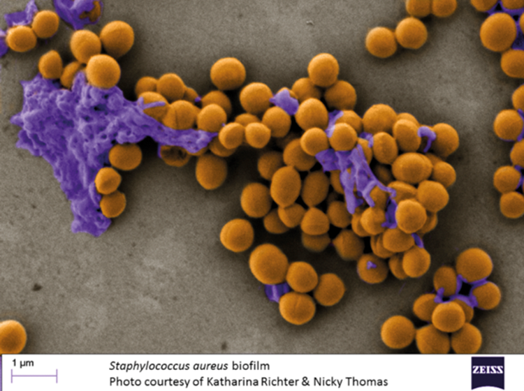 staphylococcus aureus infection in nose