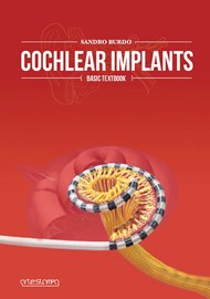 Cochlear Implants - Basic Textbook book cover image.