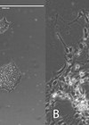 Images showing undifferentiated, human pluripotent stem cells in culture and otic neuroprogenitors generated from human pluripotent stem cells by differentiating them using chemical signals that mimic human development.