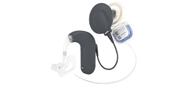 SYNCHRONY EAS Hearing Implant System