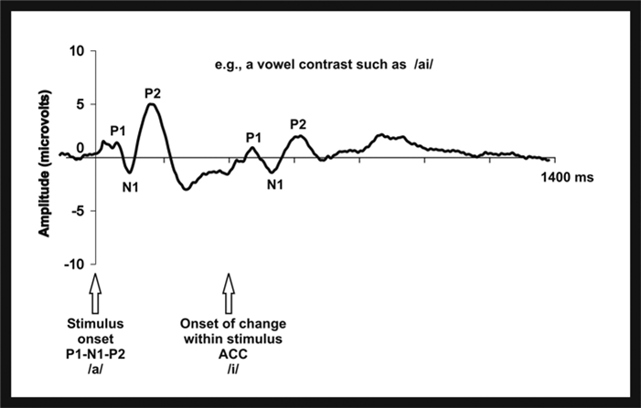 Utilisation of cortical auditory evoked potentials in the paediatric ...