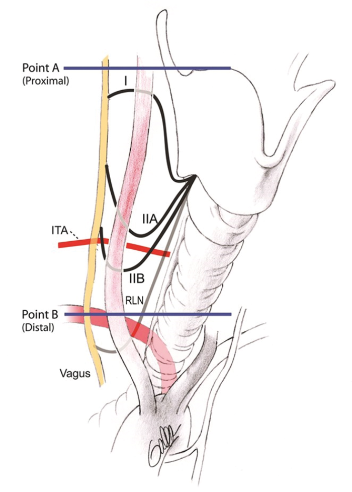 The use of a nerve stimulator for intraoperative stimulation of